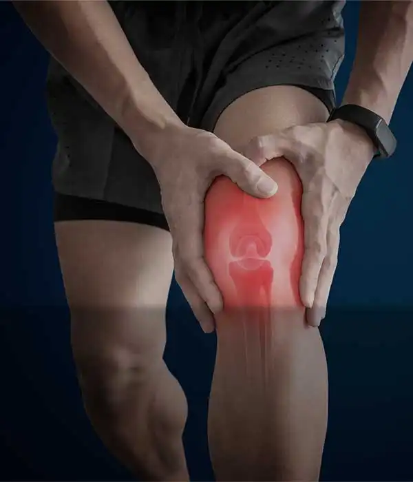 Arthritis