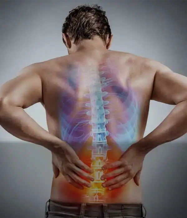 Spondylosis