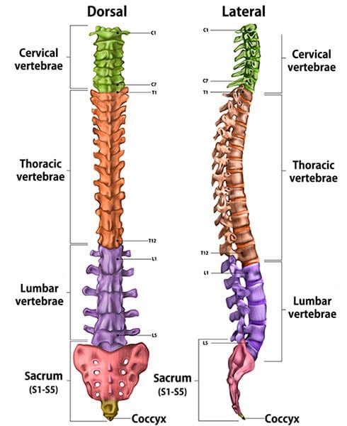 spondylosis